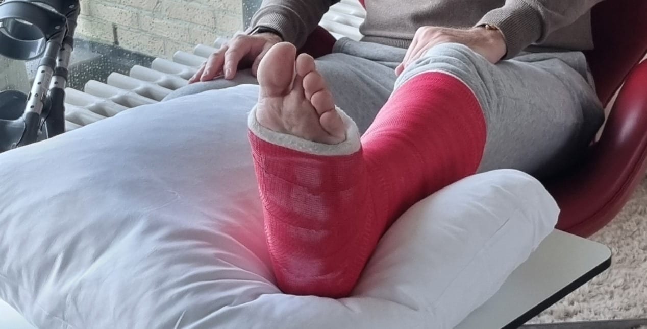 Perna com gesso apoiada numa almofada